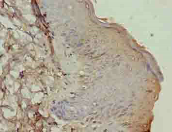 ATP12A Polyclonal Antibody