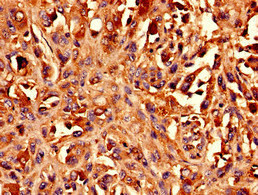 BCAT1 Polyclonal Antibody