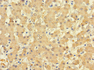 FUOM Polyclonal Antibody