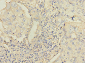 C4BPA Polyclonal Antibody