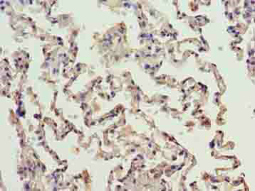 ERCC6L2 Polyclonal Antibody