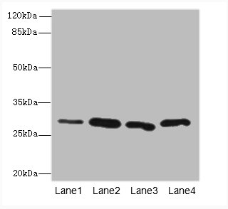 CA3 Polyclonal Antibody