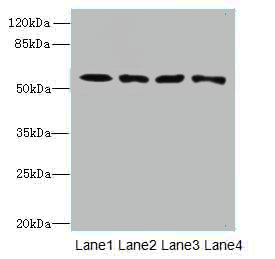 CAP2 Polyclonal Antibody