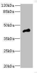 CASQ1 Polyclonal Antibody