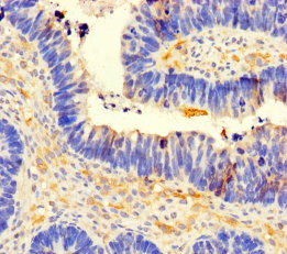 CCDC66 Polyclonal Antibody
