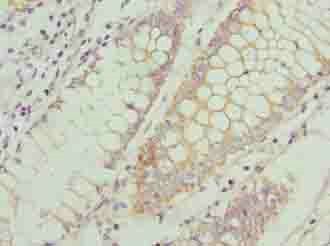 CCR1 Polyclonal Antibody