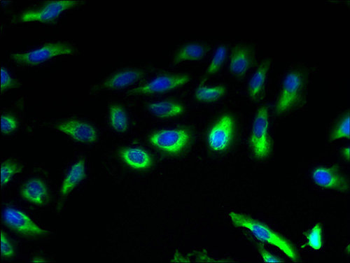 CCR4 Polyclonal Antibody