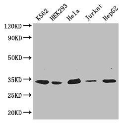 CDK2 Polyclonal Antibody (100 µl)