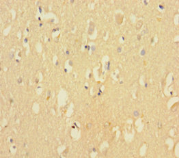 CDK2AP2 Polyclonal Antibody