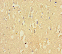 CDK2AP2 Polyclonal Antibody (100 µl)