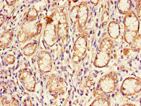 CDKN2B Polyclonal Antibody