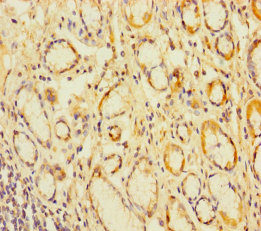 CEACAM7 Polyclonal Antibody
