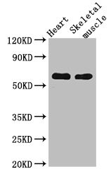 CES1 Polyclonal Antibody (100 µl)