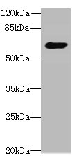 CHEK2 Polyclonal Antibody