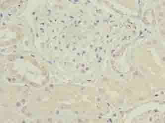 CKS2 Polyclonal Antibody