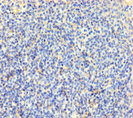 CLDN12 Polyclonal Antibody