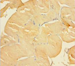 CLIC2 Polyclonal Antibody