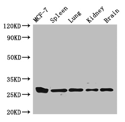 CMA1 Polyclonal Antibody