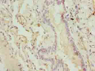 CMC1 Polyclonal Antibody