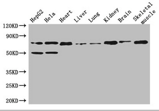 COL8A1 Polyclonal Antibody