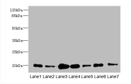 COPZ1 Polyclonal Antibody