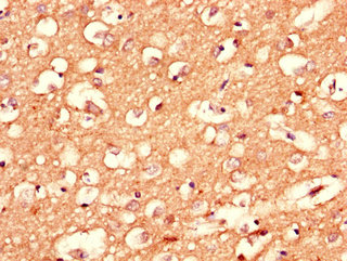 CPLX1 Polyclonal Antibody