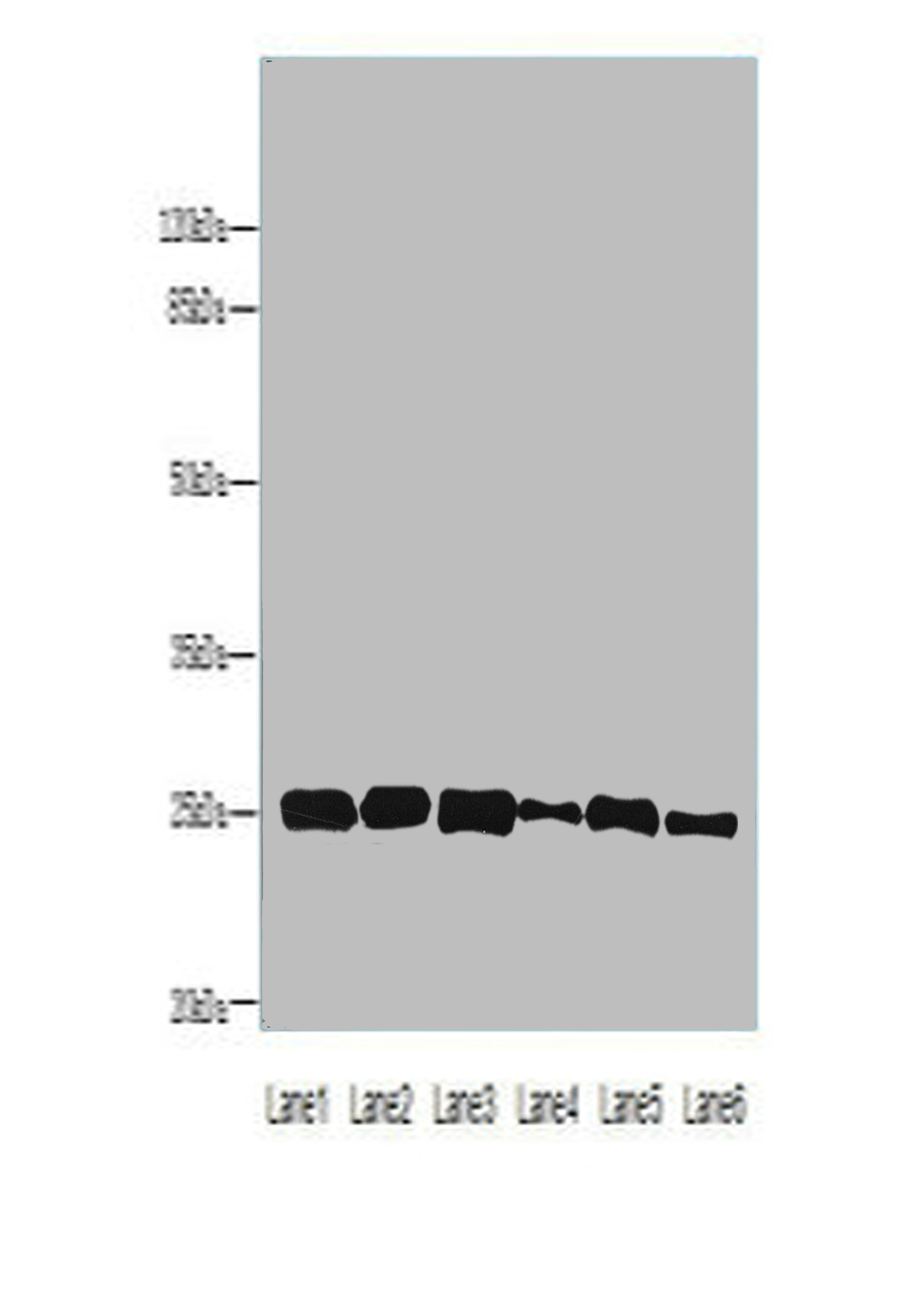 CRYBA1 Polyclonal Antibody