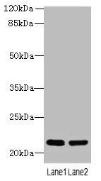 CRYBA4 Polyclonal Antibody
