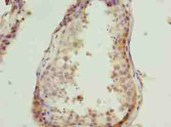 CSAG1 Polyclonal Antibody