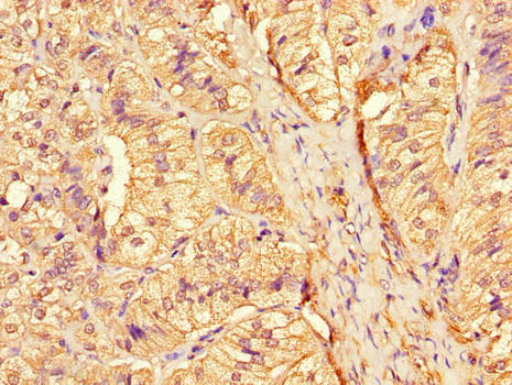 CTSA Polyclonal Antibody