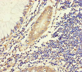 HYPM Polyclonal Antibody