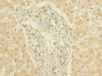 CYP3A7 Polyclonal Antibody