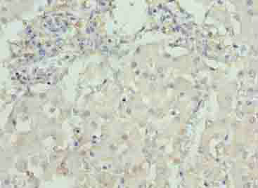 DCX Polyclonal Antibody