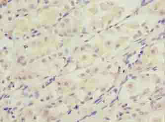 DDIT3 Polyclonal Antibody