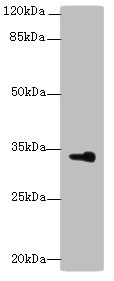 DHRS3 Polyclonal Antibody