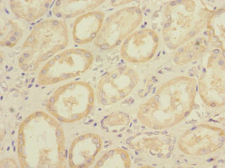 DNA2 Polyclonal Antibody