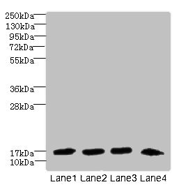 DNAL4 Polyclonal Antibody