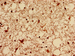 DNM1L Polyclonal Antibody