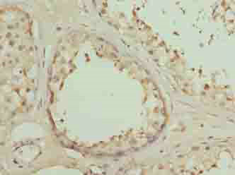 DSCR9 Polyclonal Antibody