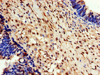 EEF2K Polyclonal Antibody