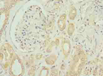 EMP1 Polyclonal Antibody