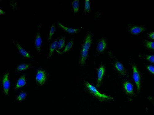 EMP3 Polyclonal Antibody