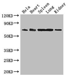 ENTPD7 Polyclonal Antibody