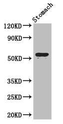 ENTPD8 Polyclonal Antibody