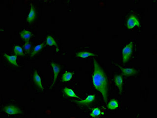 ESD Polyclonal Antibody