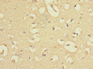 EVI2A Polyclonal Antibody