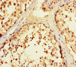 F2R Polyclonal Antibody