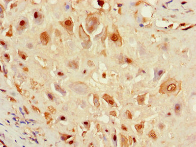 F8 Polyclonal Antibody