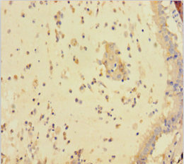 FAM107A Polyclonal Antibody
