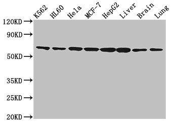 EIF3D Polyclonal Antibody